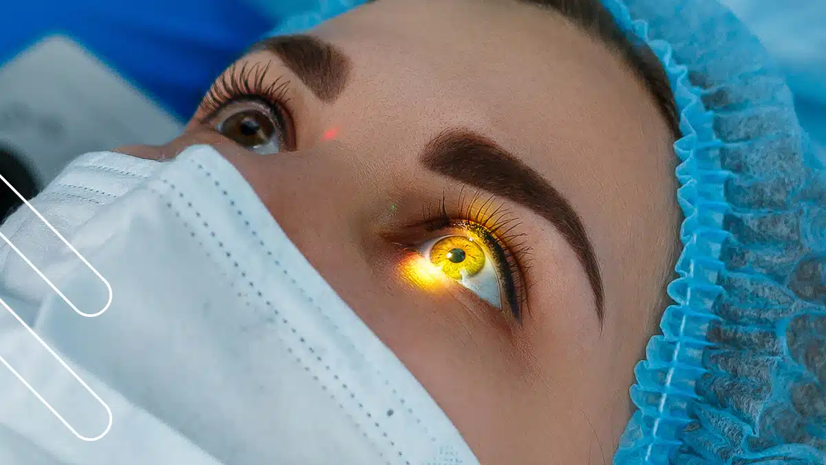 Tratamientos Láser para Glaucoma (SLT e Iridotomía YAG)